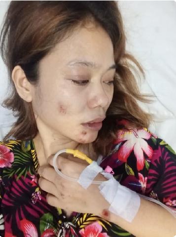 Polisi Anggap Janggal Kasus Perempuan di Medan yang Diduga Dirampok dan Ditipu
